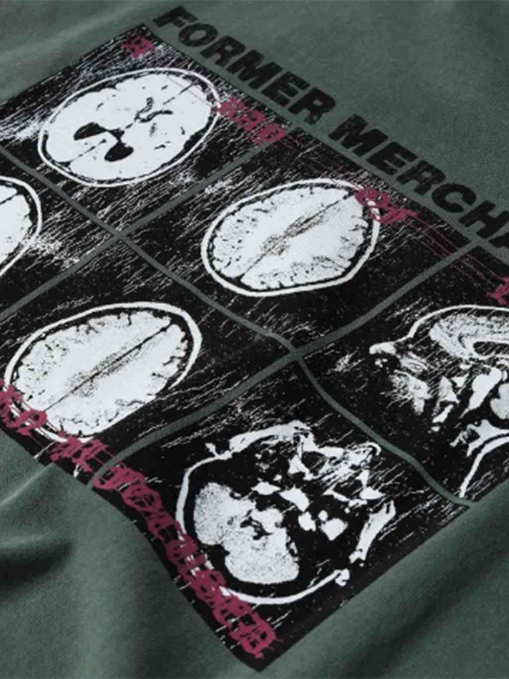 Brain Scan Oversized S/S Tee - Image 4
